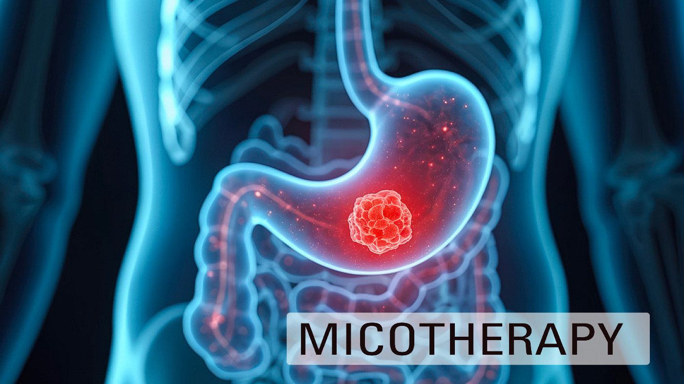 Beta-Glucani in Oncologia: uno Studio Esplorativo nel Carcinoma Gastrico Avanzato